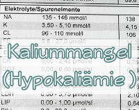 Artikelvorschau  - Kaliummangel - Symptome, Ursachen, Therapie